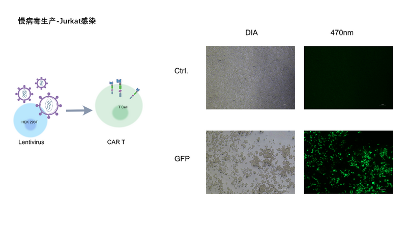 File:Hu-project2-GFP lenti.生产.PNG